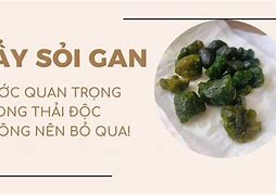 Cách Tẩy Sỏi Gan