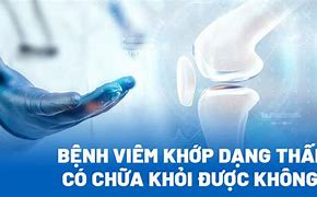 Viêm Khớp Dạng Thấp Có Chữa Khỏi Được Không